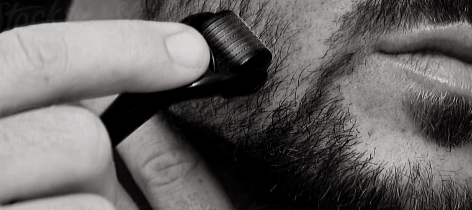 What's A Derma Roller And How Will It Help My Beard?