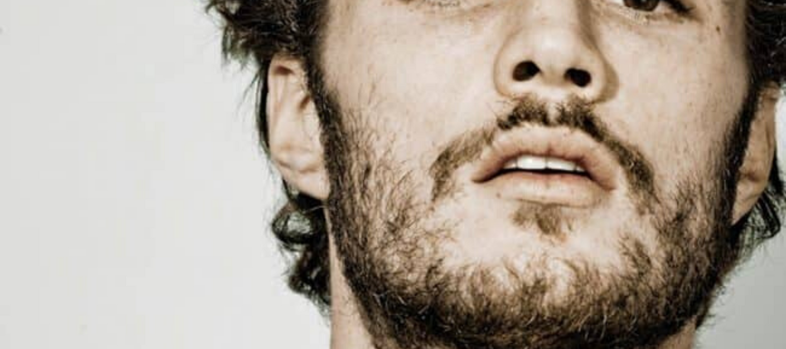 Do Beard Transplants Work