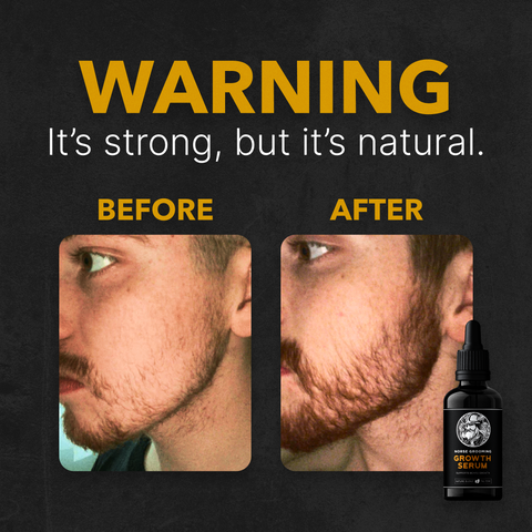 Norse Beard Growth Serum